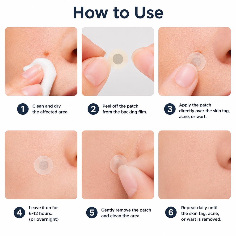 🇺🇸🇺🇸𝐇𝐢𝐬𝐤𝐢𝐧® 2-in-1 Microneedle & Hydrocolloid Patch | Removes raised moles, acne, flat warts, and skin tags | Helps improve wrinkles, scars, and blemishes | Invisible patches for face and body