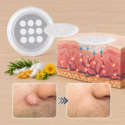 🇺🇸🇺🇸𝐇𝐢𝐬𝐤𝐢𝐧® 2-in-1 Microneedle & Hydrocolloid Patch | Removes raised moles, acne, flat warts, and skin tags | Helps improve wrinkles, scars, and blemishes | Invisible patches for face and body